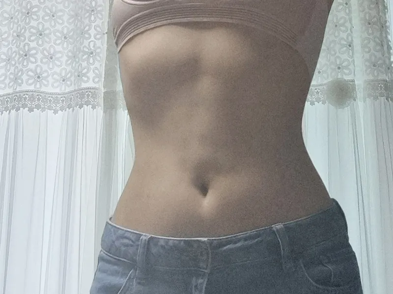Abdomen liposuction after