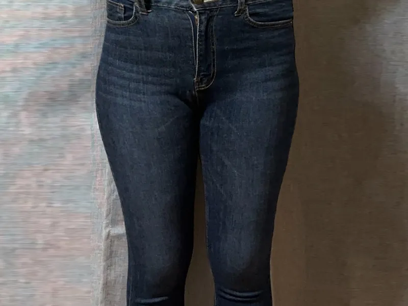 Thigh liposuction before