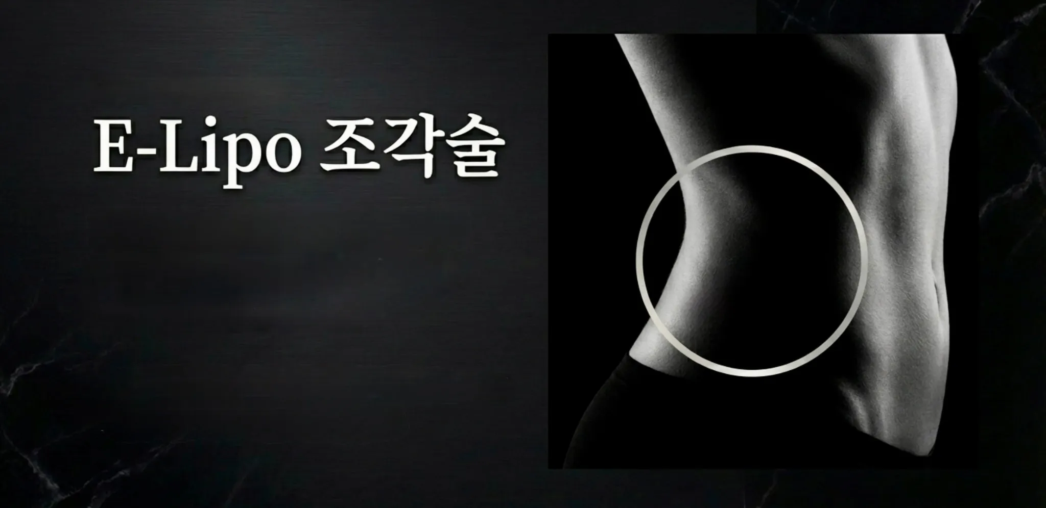 STEP 1 E-Lipo彫刻術 背中 脇腹 太もも 脂肪吸引